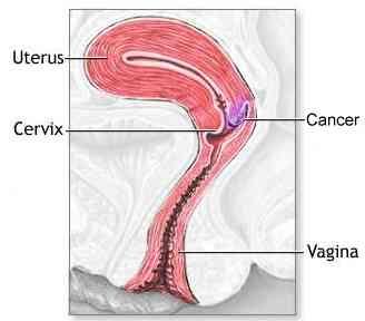 cervix